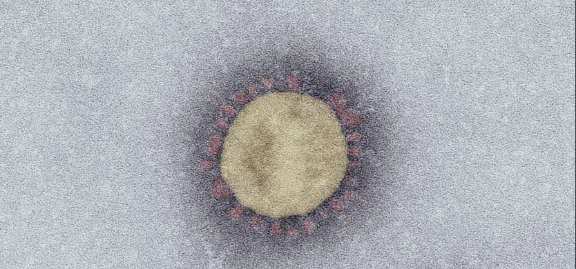 SARS-Coronavirus-2 (SARS-CoV-2, Isolat SARS-CoV-2/Italy-INMI1). Elektronenmikroskopie, Negativkontrastierung (PTA). Maßstab: 100 nm (Foto: Robert Koch-Institut)