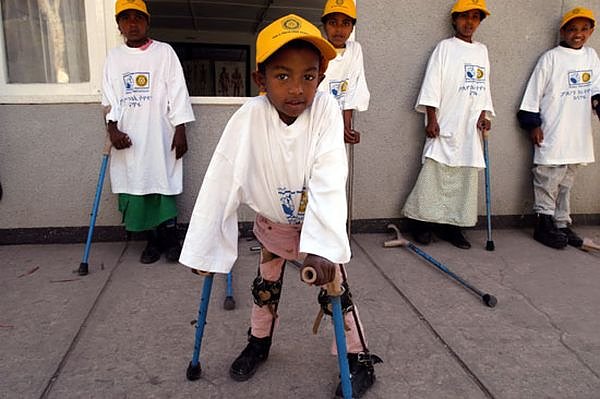 Bild: Gegen Polio