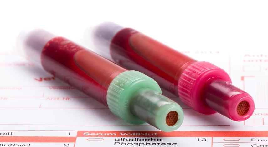 Bild: sepsis