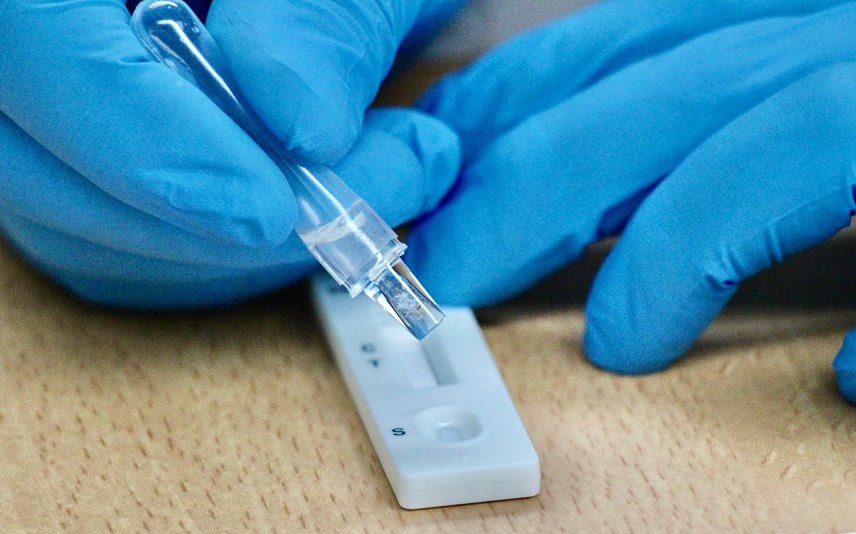 Bild: Durchf&uuml;hrung eines Antigen-Schnelltests in SDH