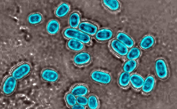 Erreger (Foto: © řour Photo Today / Cavallini James) Erreger (Foto: © řour Photo Today / Cavallini James)