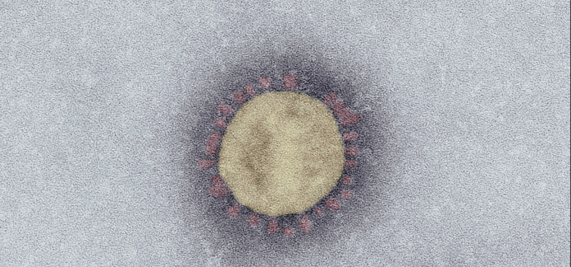 SARS-Coronavirus-2 (SARS-CoV-2, Isolat SARS-CoV-2/Italy-INMI1). Elektronenmikroskopie, Negativkontrastierung (PTA). Maßstab: 100 nm (Foto: Robert Koch-Institut: SurvStat@RKI 2.0)